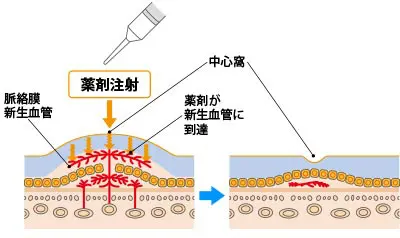 おしらせ | 島本眼科医院